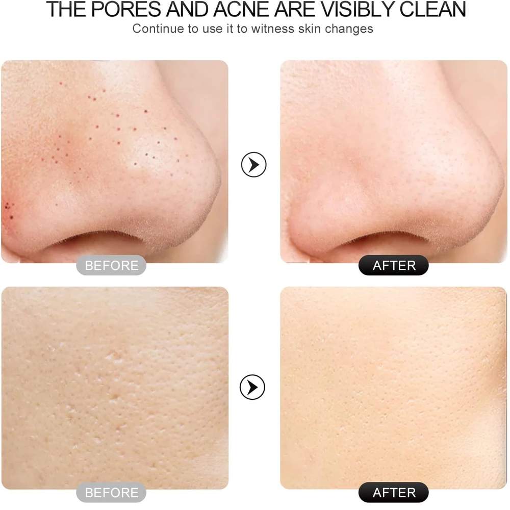 Ultrasonic Skin Scrubber – Facial Spatula Deep Cleansing Tool